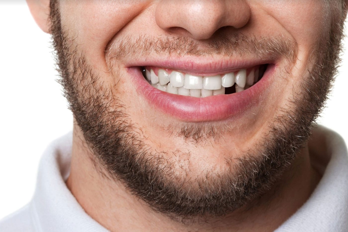 Cracked or Broken Teeth Treatment