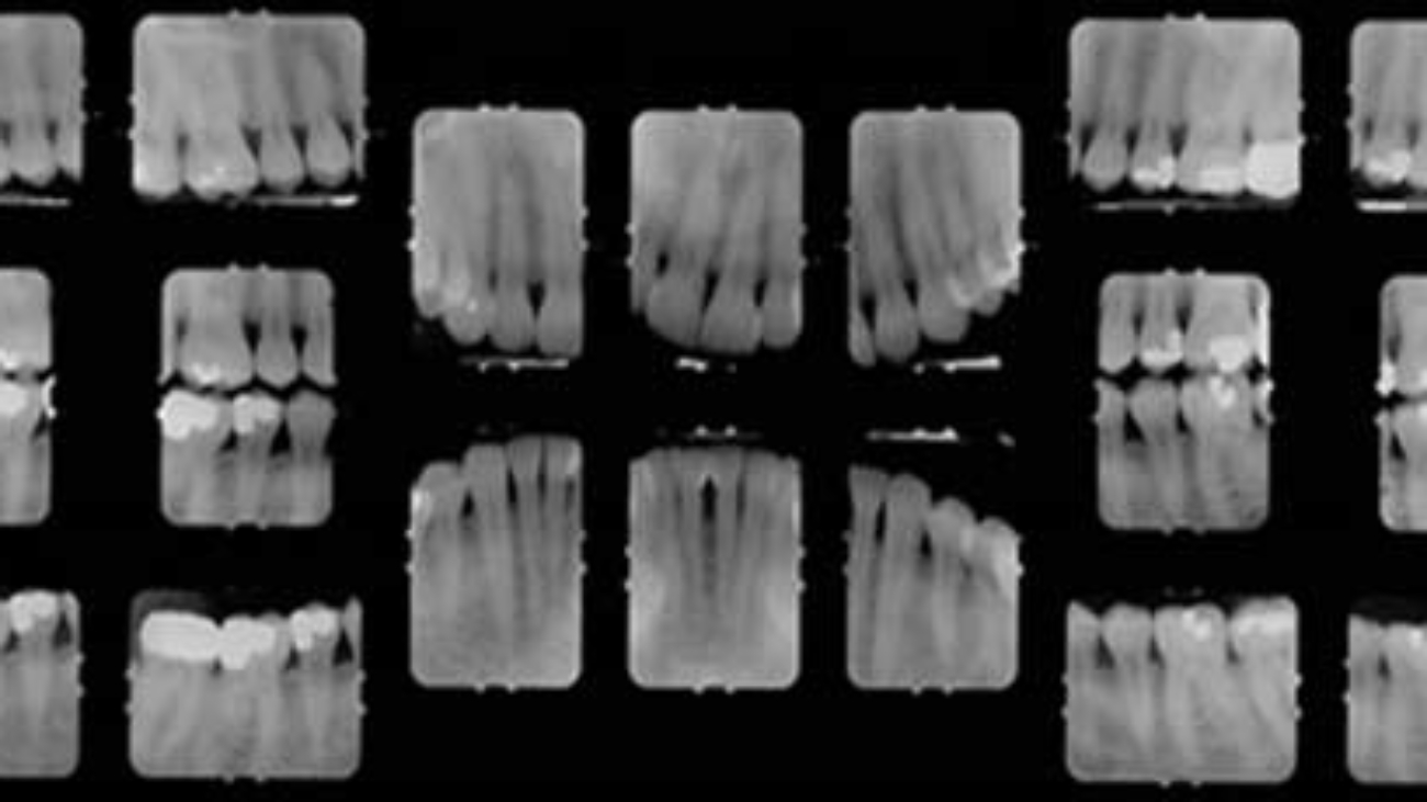 xray