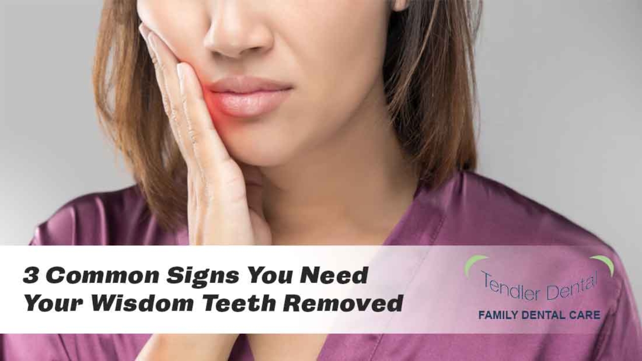 3 Common Signs You Need Your Wisdom Teeth Removed