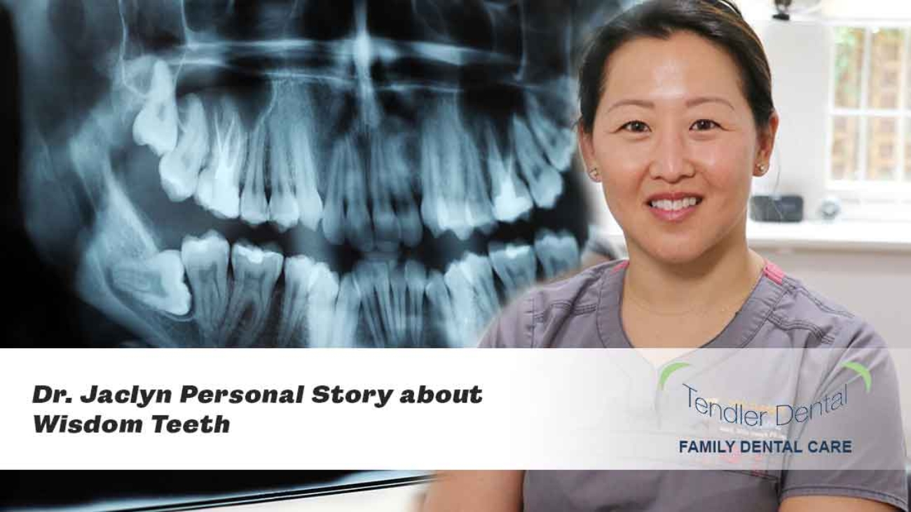 Dr Jaclyn Wong Personal Story About Wisdom Teeth