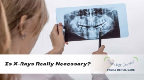 Is X-Rays Really Necessary