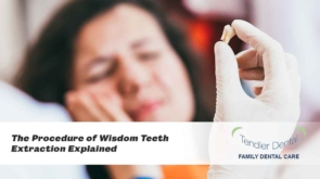 The Procedure of Wisdom Teeth Extracction Explained